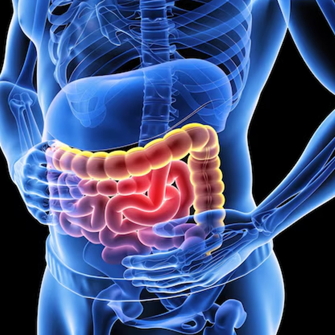 Transforme Seu Sistema Digestivo Os Melhores Suplementos para Saúde Intestinal