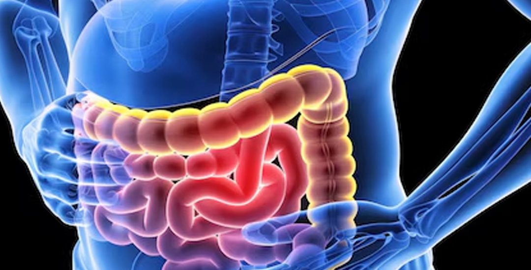 Transforme Seu Sistema Digestivo Os Melhores Suplementos para Saúde Intestinal